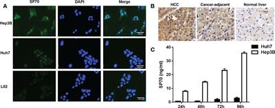 SP70 is a novel biomarker of hepatocellular carcinoma